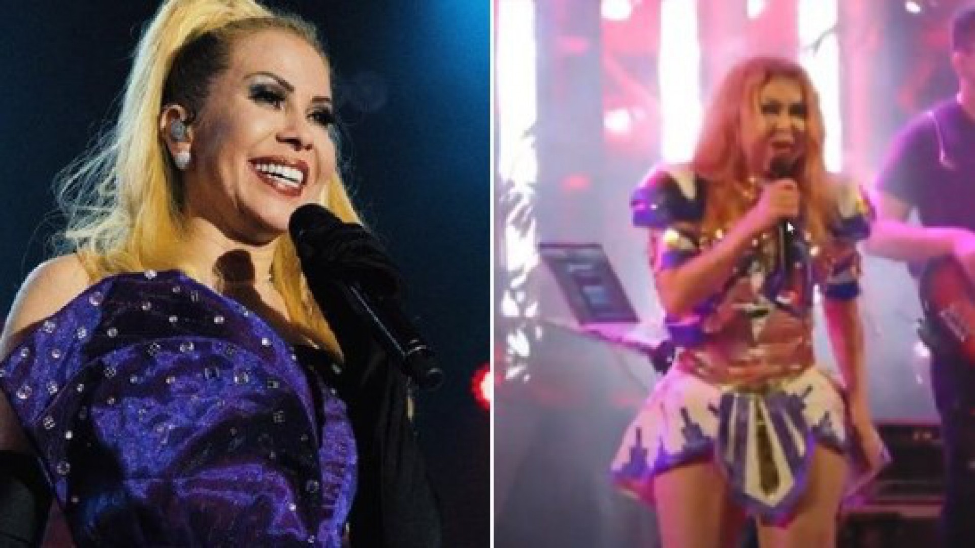 Joelma Causa Preocupa O Nos F S Ao Aparecer Rosto Inchado Em Show