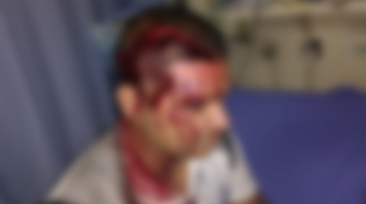 Policial ficou ferido após ser atingido na cabeça