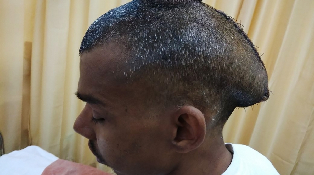 Radiografia do tumor