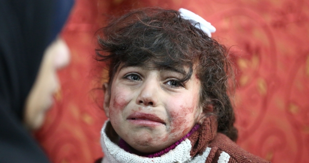 Hala, 9, receives treatment at a makeshift hospital following Syrian government bombardments on rebel-held town of Saqba, in the besieged Eastern Ghouta region on the outskirts of the capital Damascus on February 22, 2018. / AFP PHOTO / AMER ALMOHIBANY