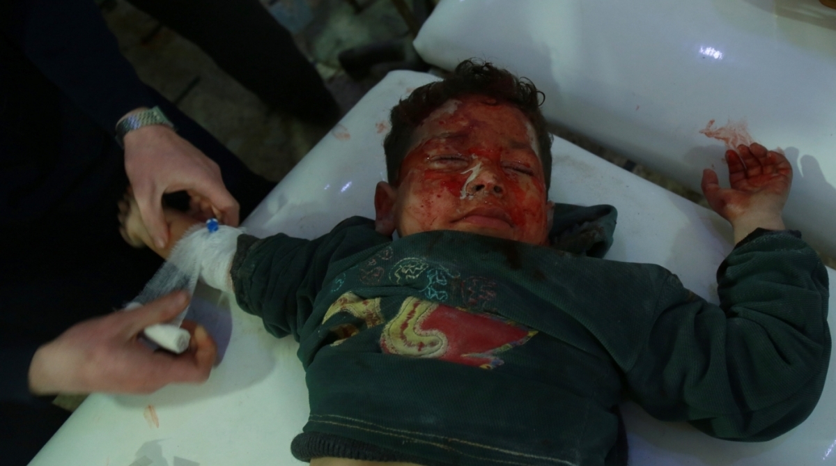 EDITORS NOTE: Graphic content / A  Syrian medic treats a wounded child at a makeshift hospital  in the rebel-held town of Douma, in the besieged Eastern Ghouta region on the outskirts of the capital Damascus, following air strikes by regime forces on the area on February 23, 2018.
Syrian regime air strikes and artillery fire hit the rebel-held enclave of Eastern Ghouta for a sixth straight day killing dozens of civilians, as the world struggled to reach a deal to stop the carnage. / AFP PHOTO / HAMZA AL-AJWEH