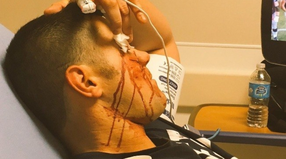 Eddie Edwards quase perdeu o olho direito - Reprodução / Twitter