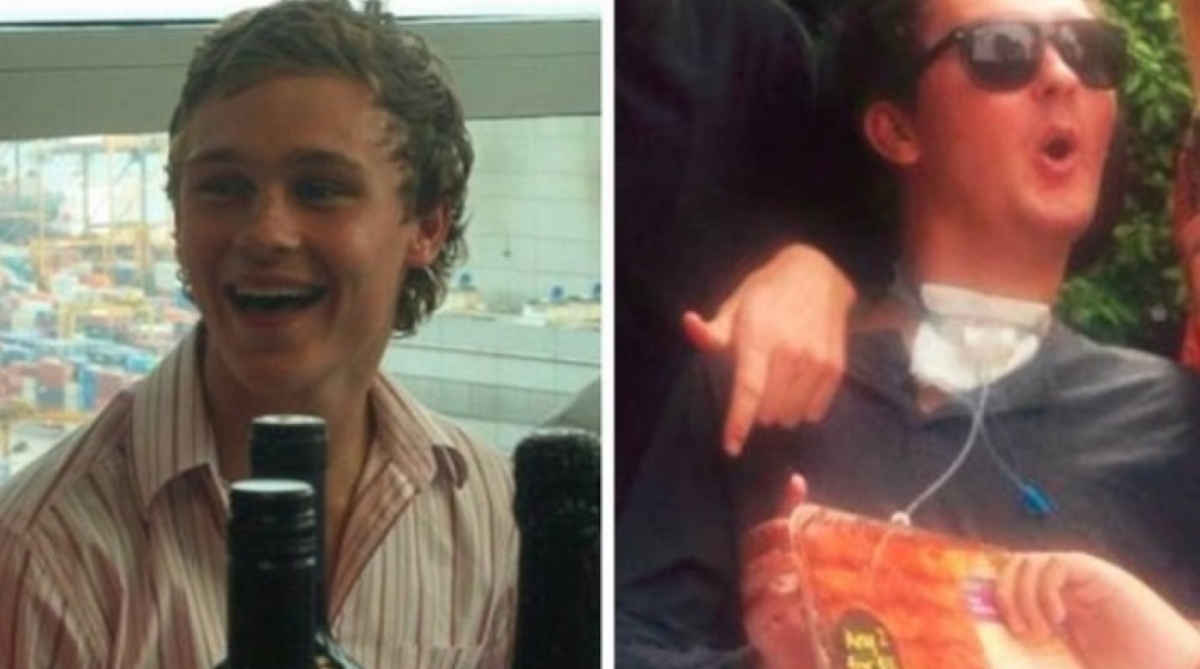 Oito anos após contrair infecção, Sam Ballard ainda sofre consequências da aposta

