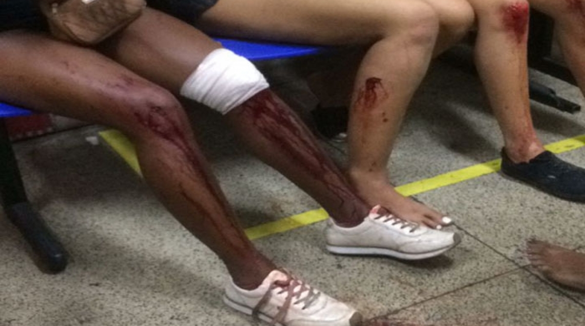 Correria em baile funk por causa de tiros deixa pelo menos 50 feridos na Penha - WhatsApp (21) 98762-8248