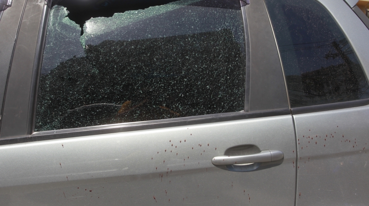 2018-03-19 - Um homem foi atingido na cabe&ccedil;a por uma bala perdida durante uma troca de tiros entre policiais e bandidos na Rua do Bispo, no Rio Comprido, na Zona Norte. Ant&ocirc;nio Carlos da Rocha Pinto, de 50 anos, foi socorrido e levado para o Hospital Casa de Portugal, que fica pr&oacute;ximo ao local do tiroteio. Foto de Ma&iacute;ra Coelho / Ag&ecirc;ncia O Dia - Pol&iacute;cia,  Assalto, Crime, Seguran&ccedil;a,