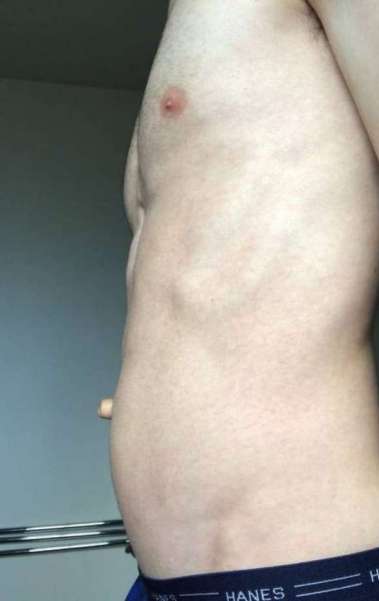 Mark exibe seu umbigo de 2,5 cm em canal na internet - Reprodução