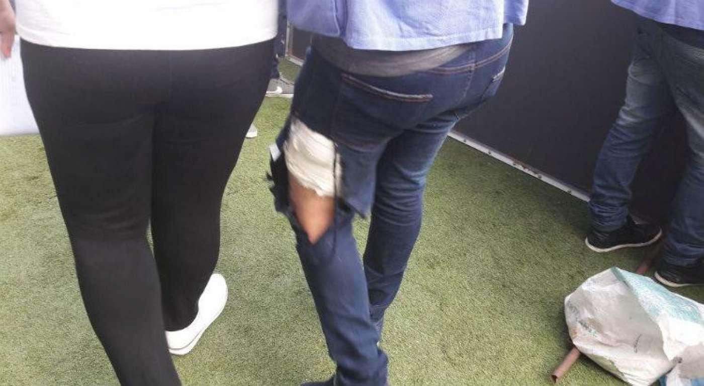 Repórter é mordido por cão policial em final na Arena Pernambuco - Reprodução