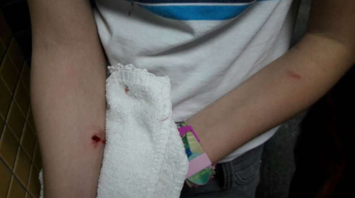 Estudante foi atingida no braço direito - WhatsApp O DIA (21) 98762-8248