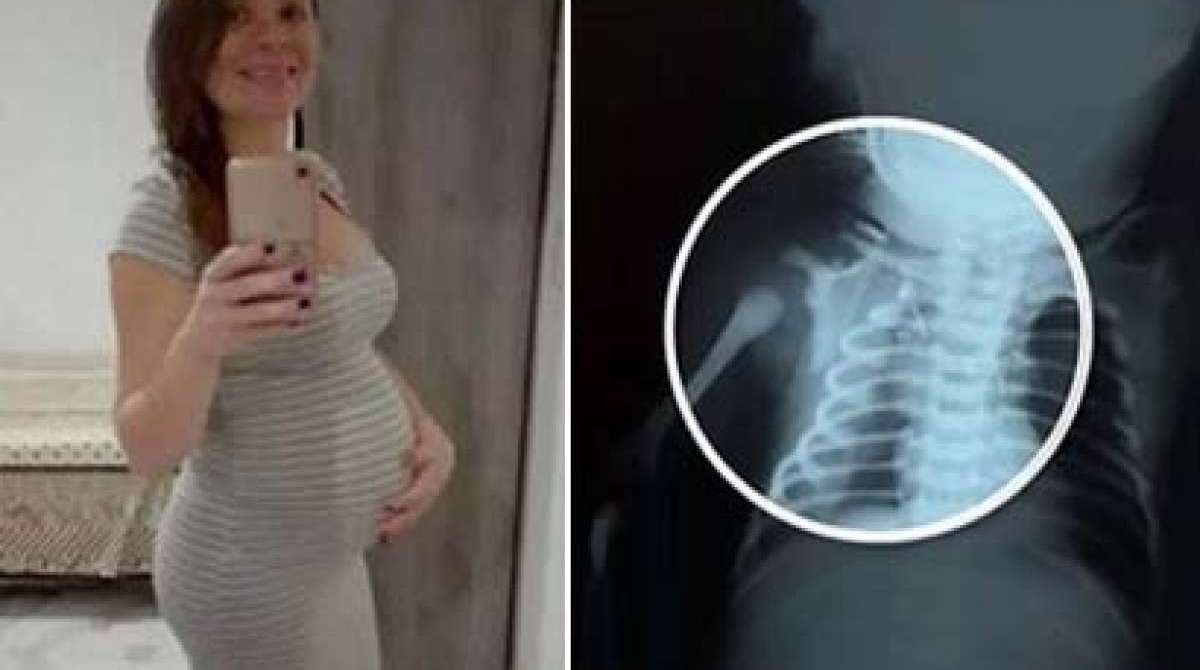 Claudineia estava com nove meses de gravidez