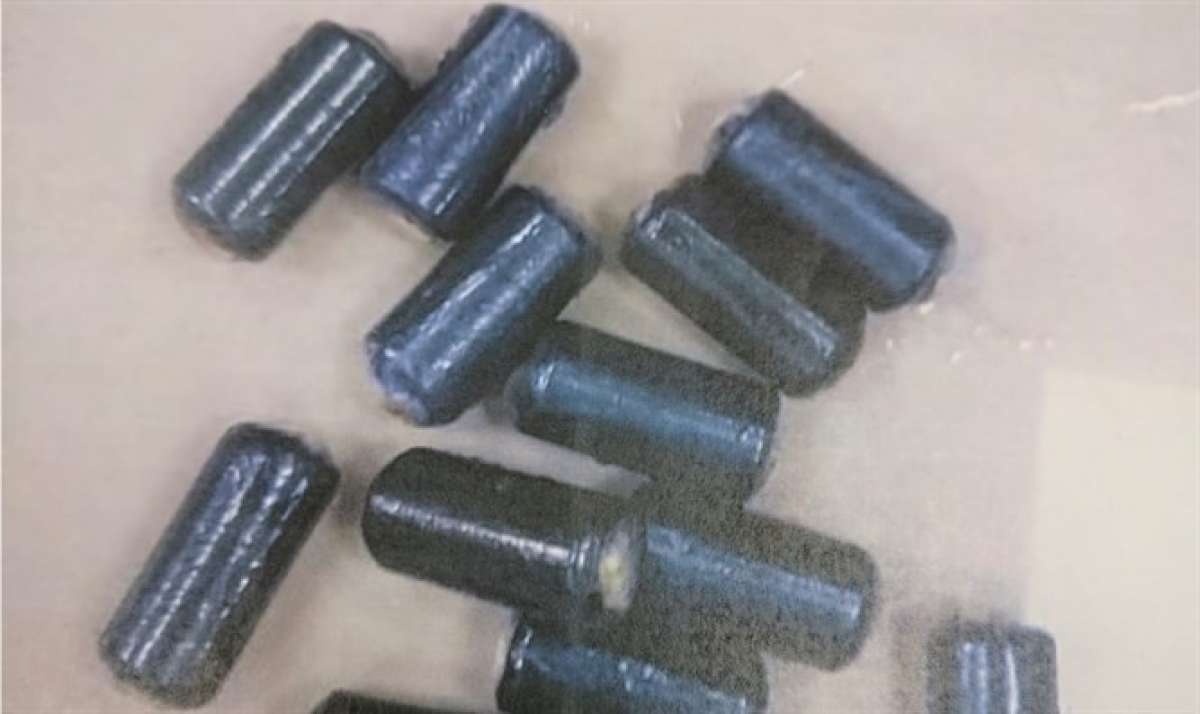 No hospital foram encontradas 50 cápsulas que totalizavam meio quilo de cocaína - Divulgação/ Polícia Israelense