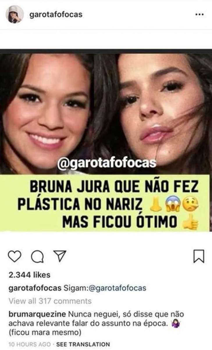 Bruna Marquezine admite plástica no nariz: 'ficou mara'