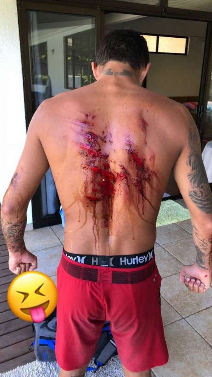 Filipe Toledo sofreu ferida enorme no Taiti
