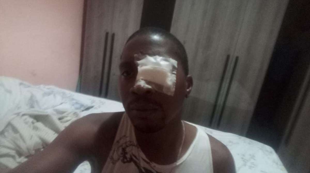 Arnaldo Silva, teve o olho cortado pela linha quando passava pela Linha Vermelha