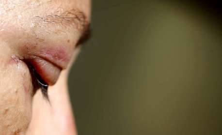 Rio teve 338 casos de violência contra mulher em 2020, aponta boletim