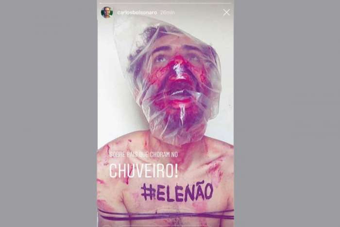 Postagem de simulação de tortura foi republicada por Carlos Bolsonaro e com frase homofóbica