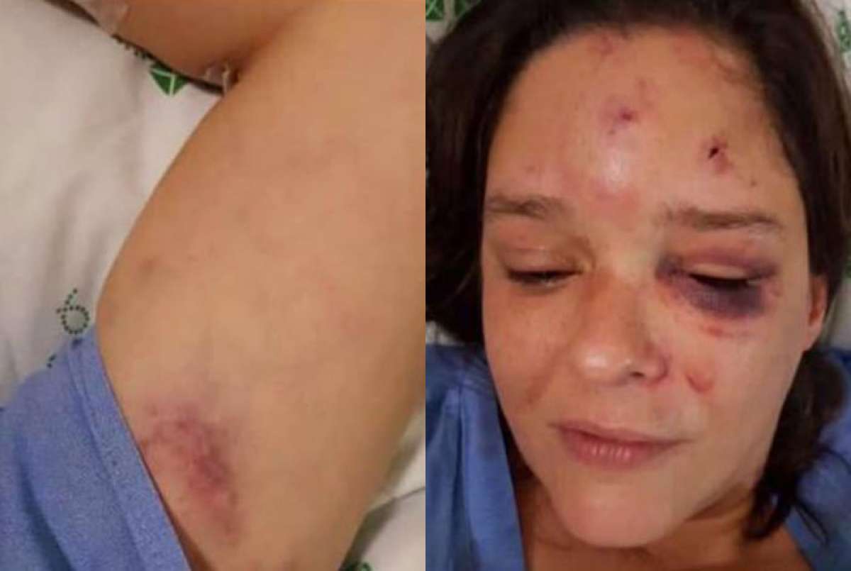 Mulher usava adesivos e bottons do então candidato à Presidência da República Ciro Gomes e do movimento #EleNão, contra a candidatura de jair Bolsonaro  - Reprodução Facebook 