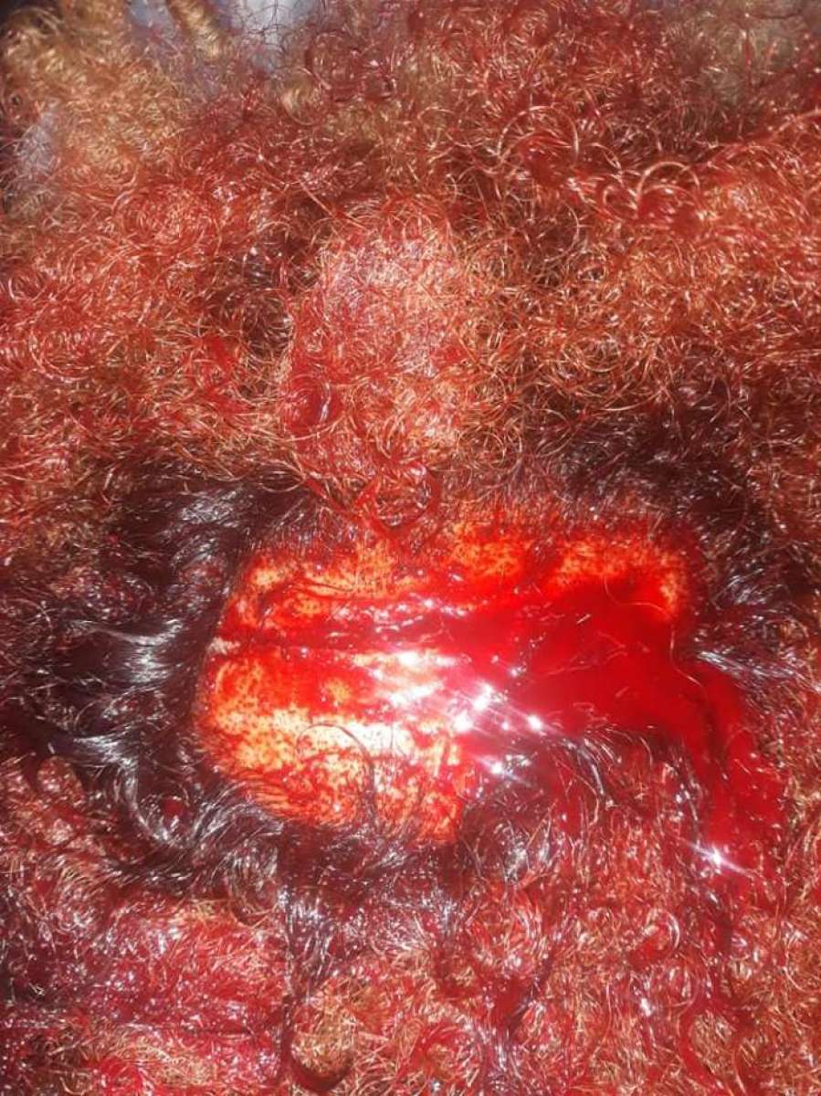 Hugo Barros denunciou agressão por homofobia no Facebook