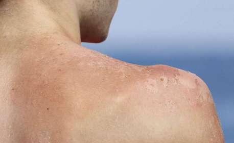 Vacina contra câncer de pele pode reduzir em até 49% o risco de morte ou retorno da doença