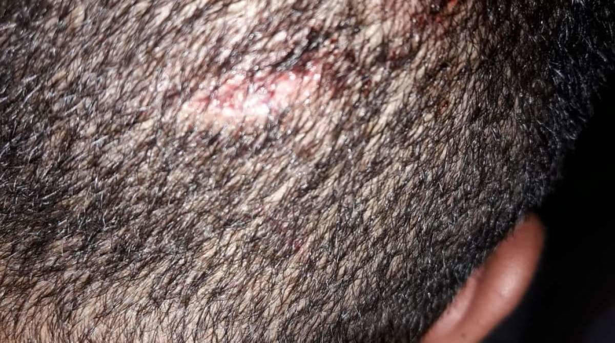 Segundo Conselho LGBTI de Niterói, jovem foi brutalmente espancado dentro do terminal de Niterói e xingado com palavras que feriam a sua orientação sexual - Reprodução Internet