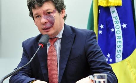 Líder do PT na Câmara diz que há sinal positivo de apoio à reeleição de Lira