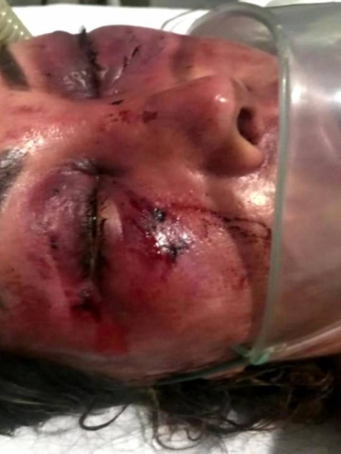 Vítima está com várias fraturas no rosto e terá que passar por cirurgia