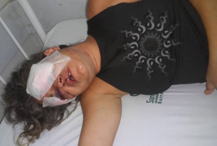 Luana Cunha da Silva, de 35 anos, foi violentamente espancada com soquete de feijão pelo ex-companheiro, Paulo Roberto Lopes da Silva Júnior