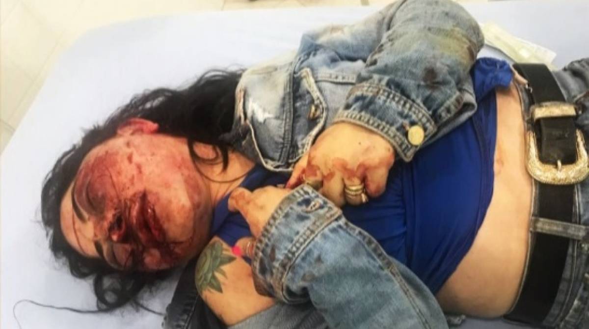 Jane Cherubim, 36 anos, foi brutalmente espancada