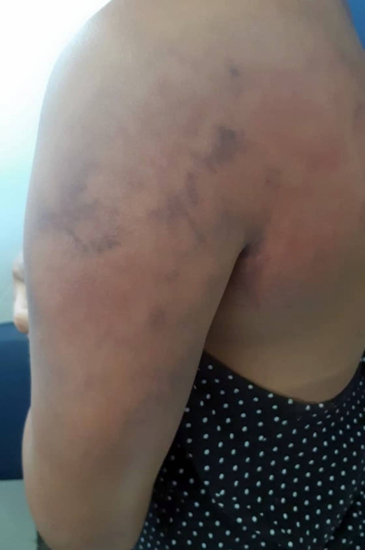 A mulher conseguiu escapar após uma distração do marido