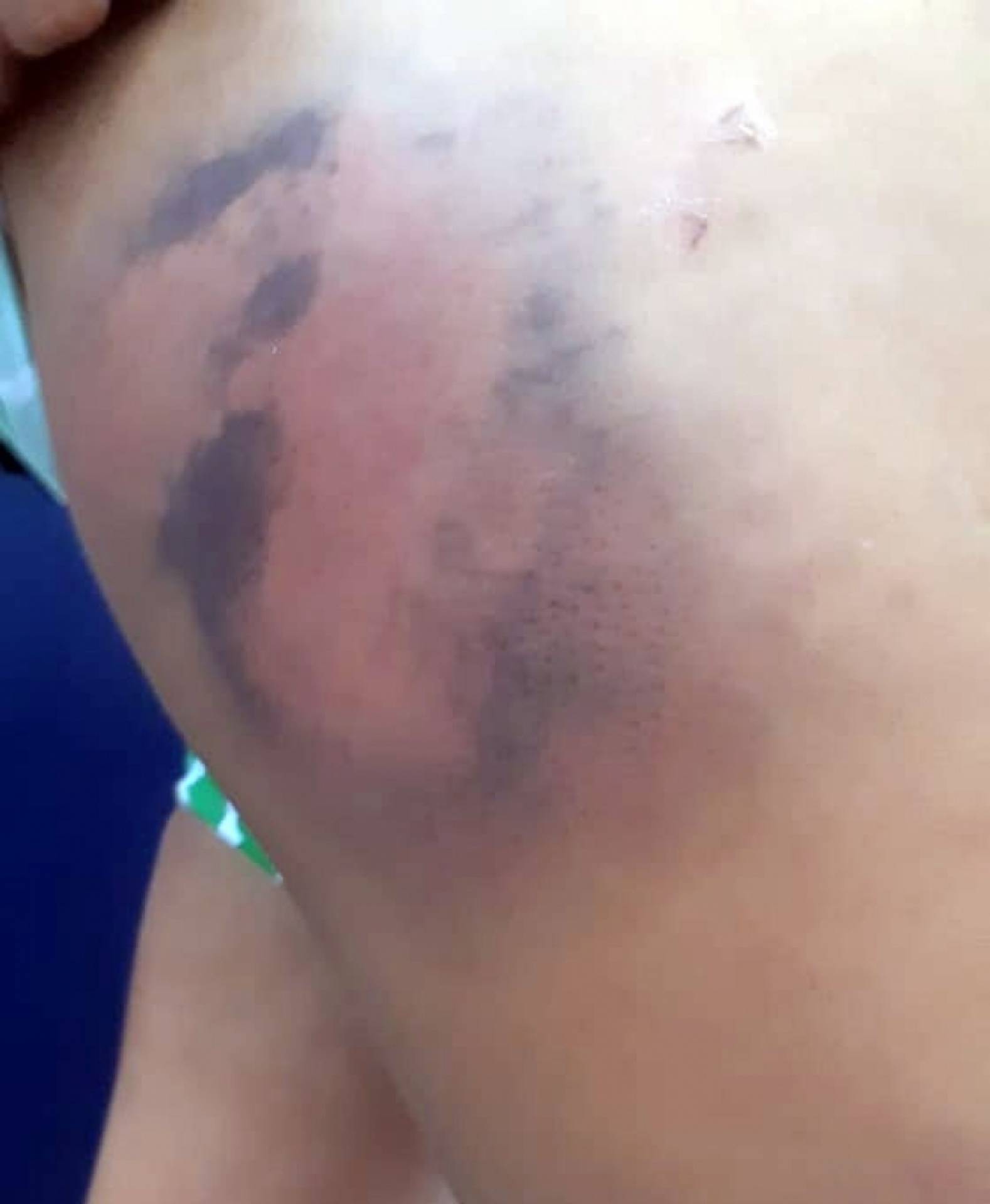 A sessão de tortura durou cerca de seis horas