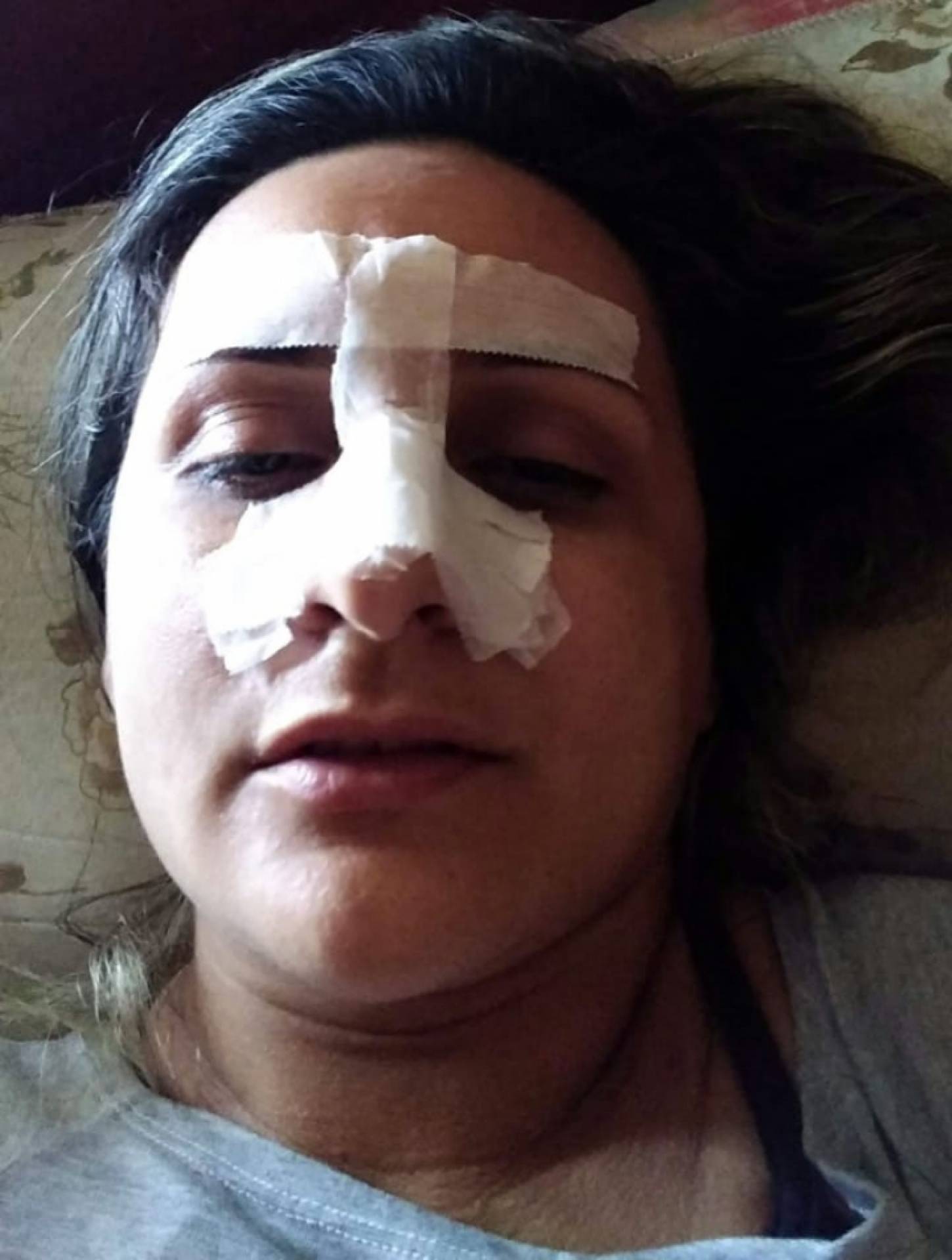 Rosana chegou a ter o nariz quebrado