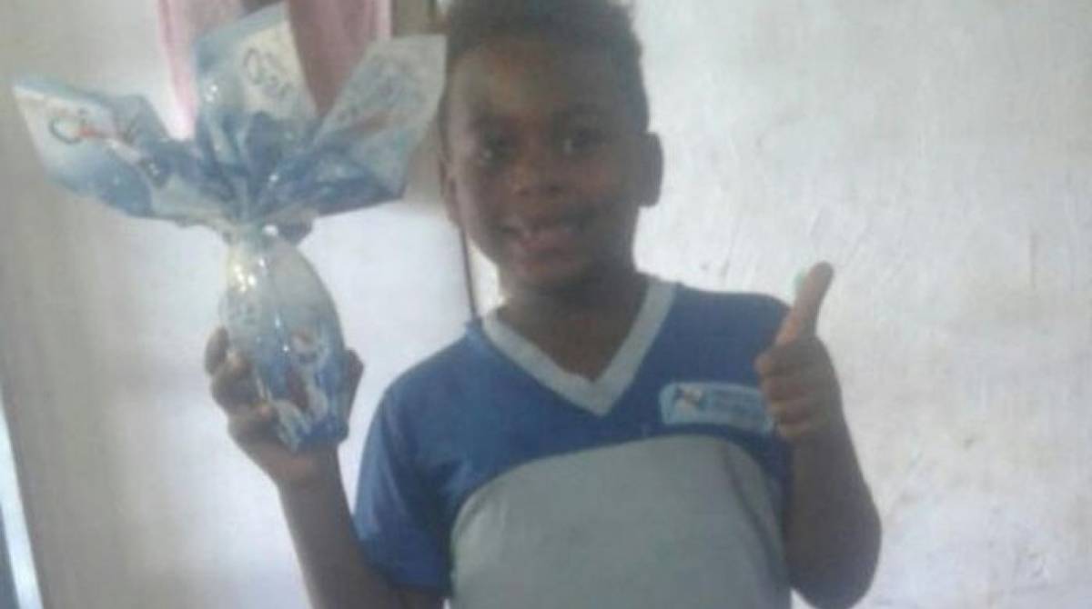 Adrian teve 60% do corpo queimado e está em estado gravíssimo  - Reprodução 