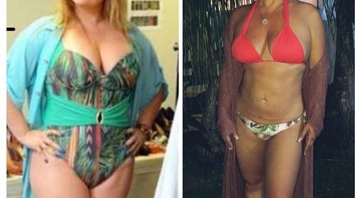 Ana Paula Pituxita mostra antes e depois - Reprodução Internet