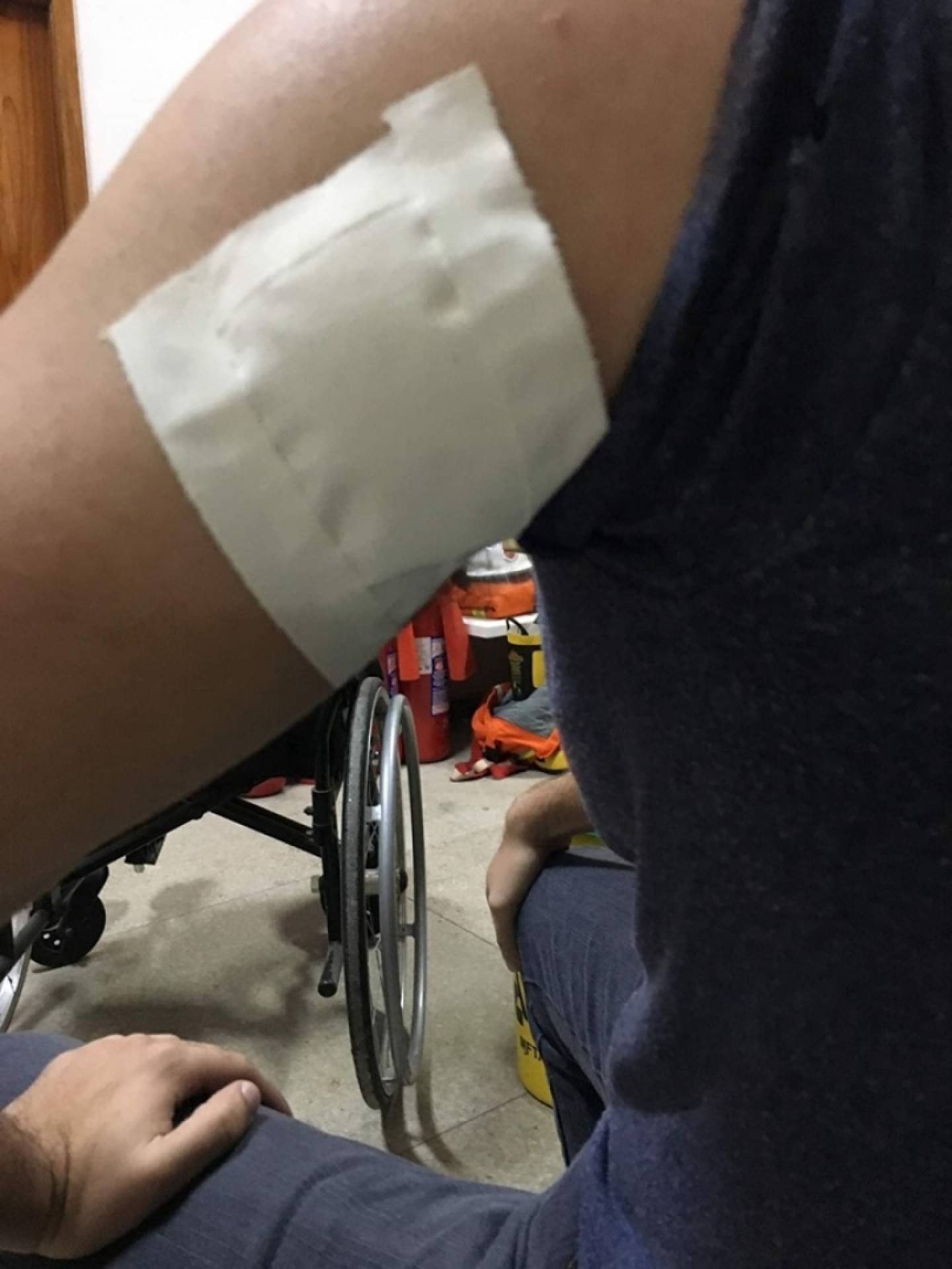 Aluno da UFRJ, que teve a identidade preservada, foi ferido por bala perdida na entrada do Centro de Ciências Matemáticas e da Natureza, no campus Fundão, na Ilha do Governador - Reprodução