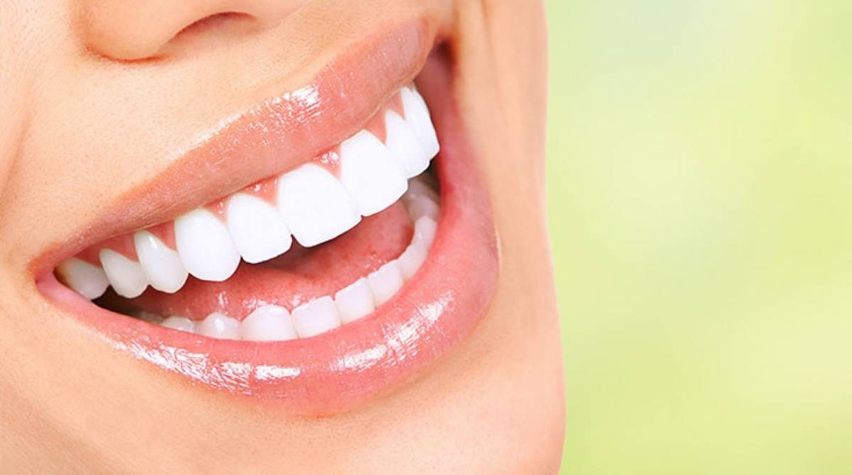 Clareamento dental