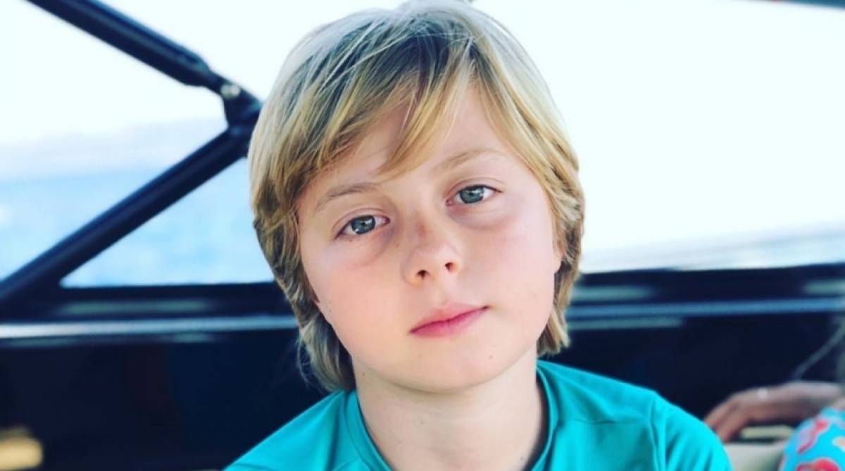 Ben&iacute;cio se desequilibrou e bateu a cabe&ccedil;a na prancha - Reprodução