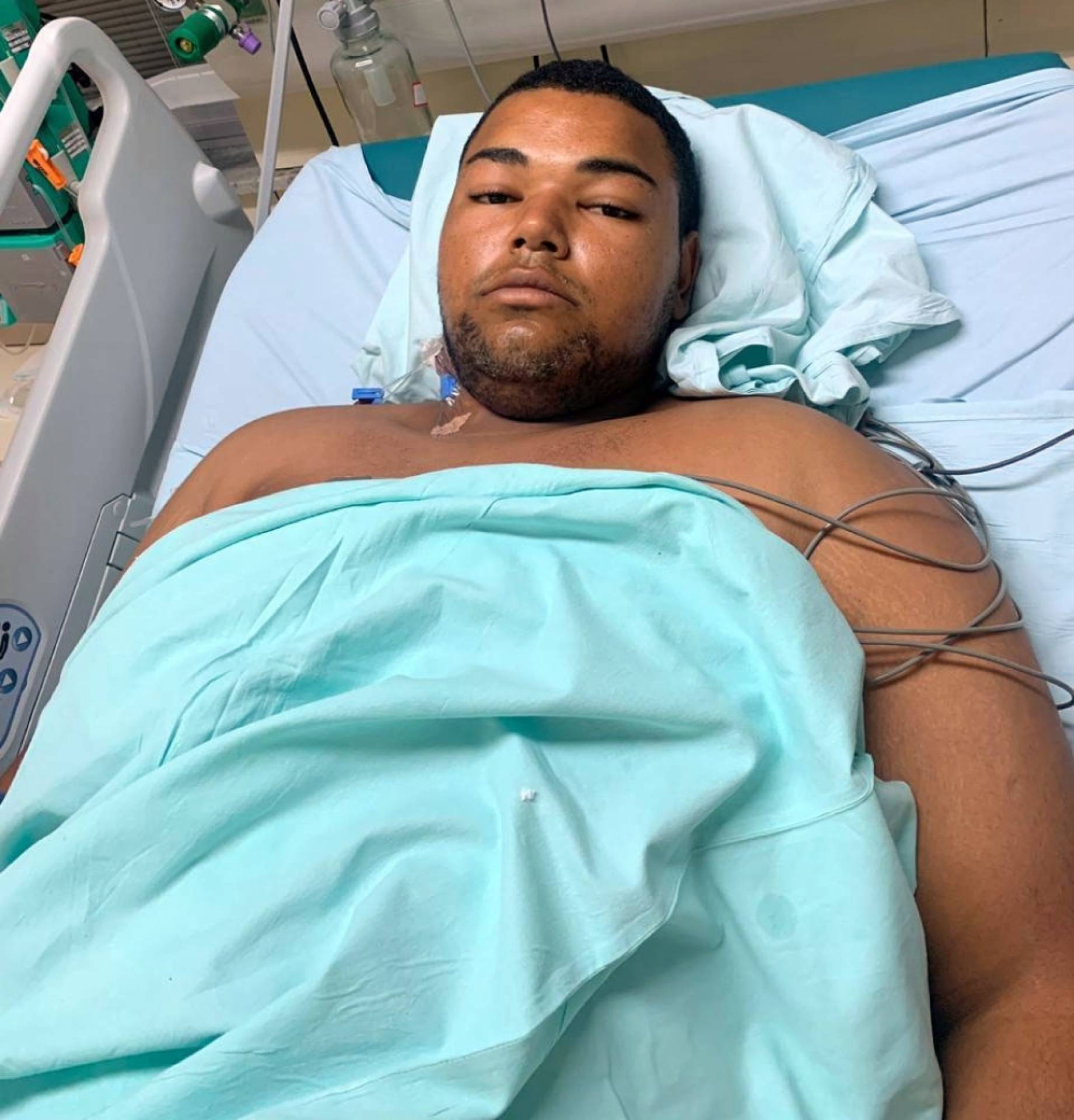 Anderson Ferreira de Souza foi baleado dias atr&aacute;s - Divulga&ccedil;&atilde;o / Pol&iacute;cia Civil