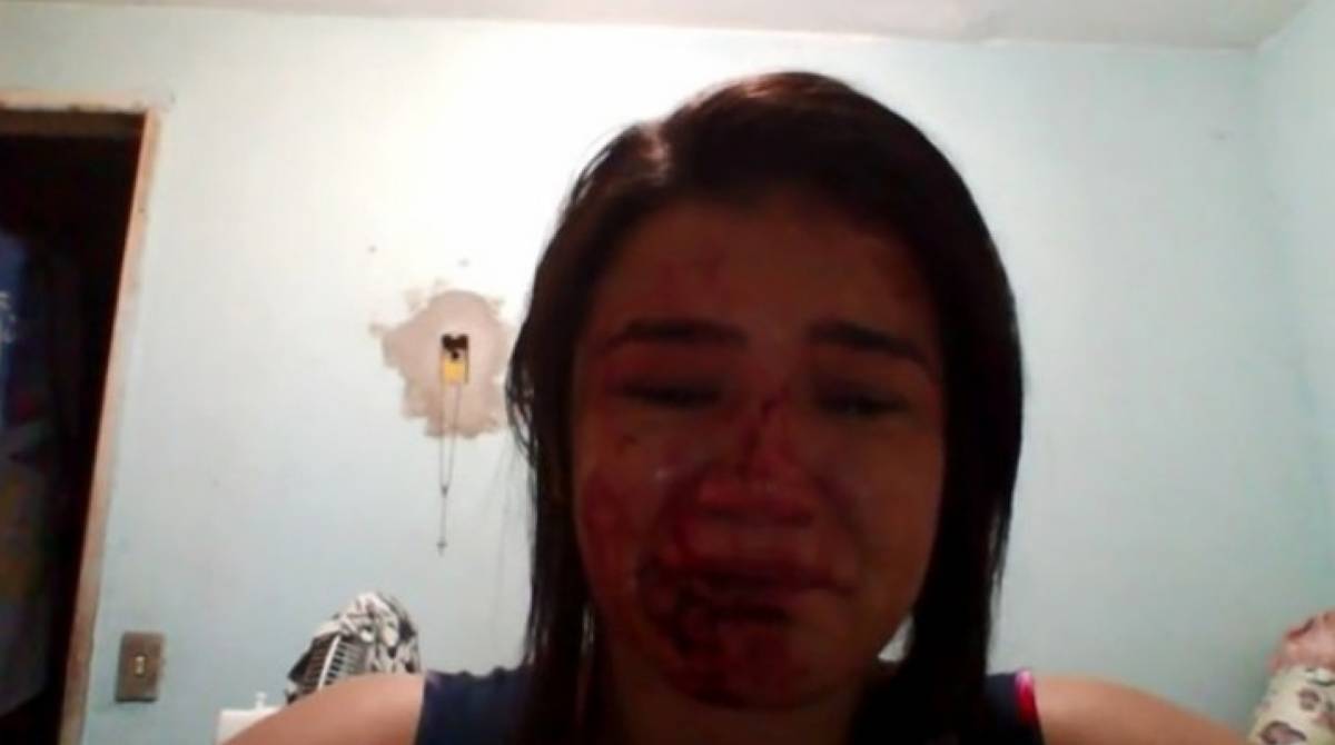 Ericka Almeida fez um vídeo onde aparece com o rosto ensanguentado após agressões
