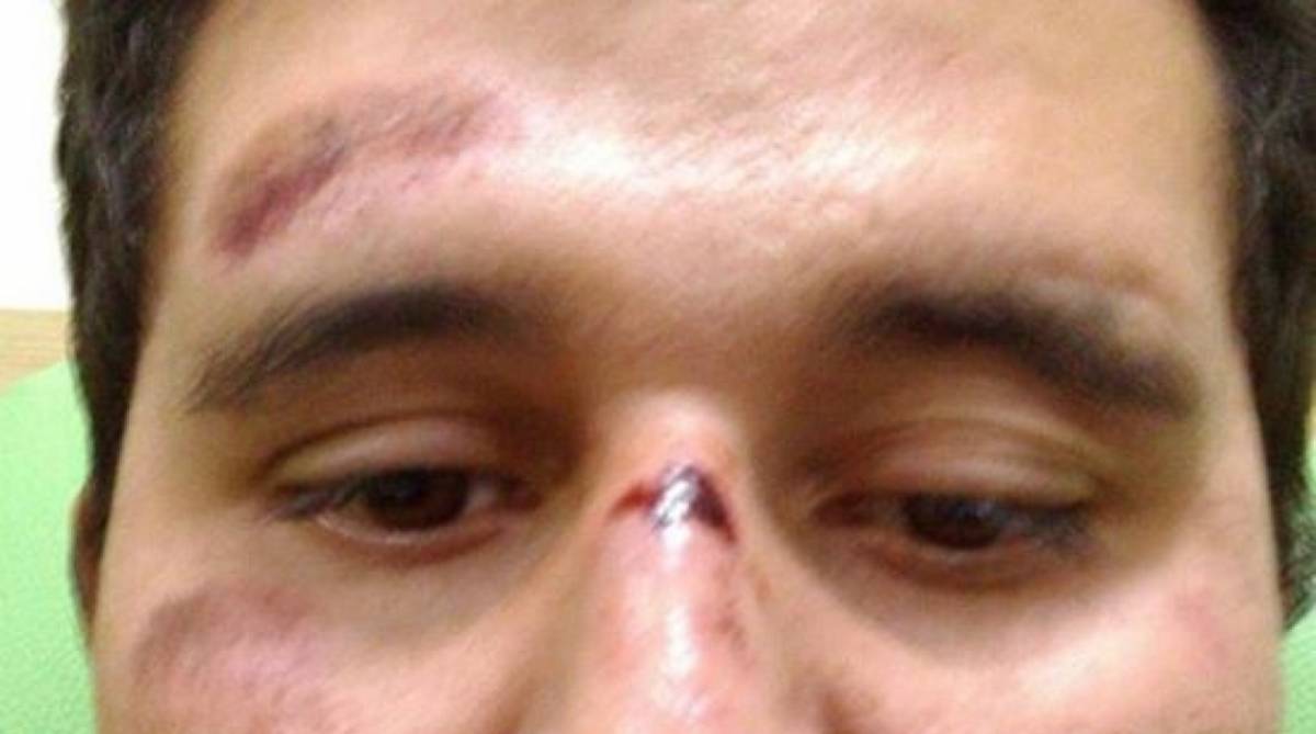 Empresário acusa irmão de deputado do PSL de agressão - Reprodução / Internet