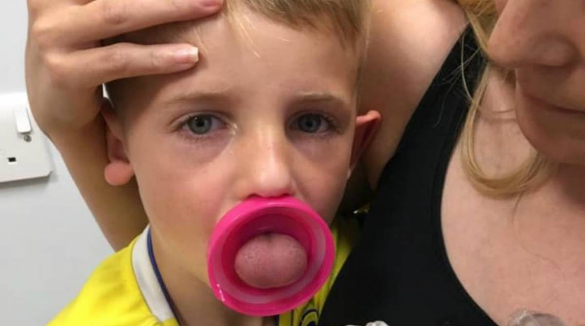 Menino passa por cirurgia após ficar com a lÃngua presa em garrafa