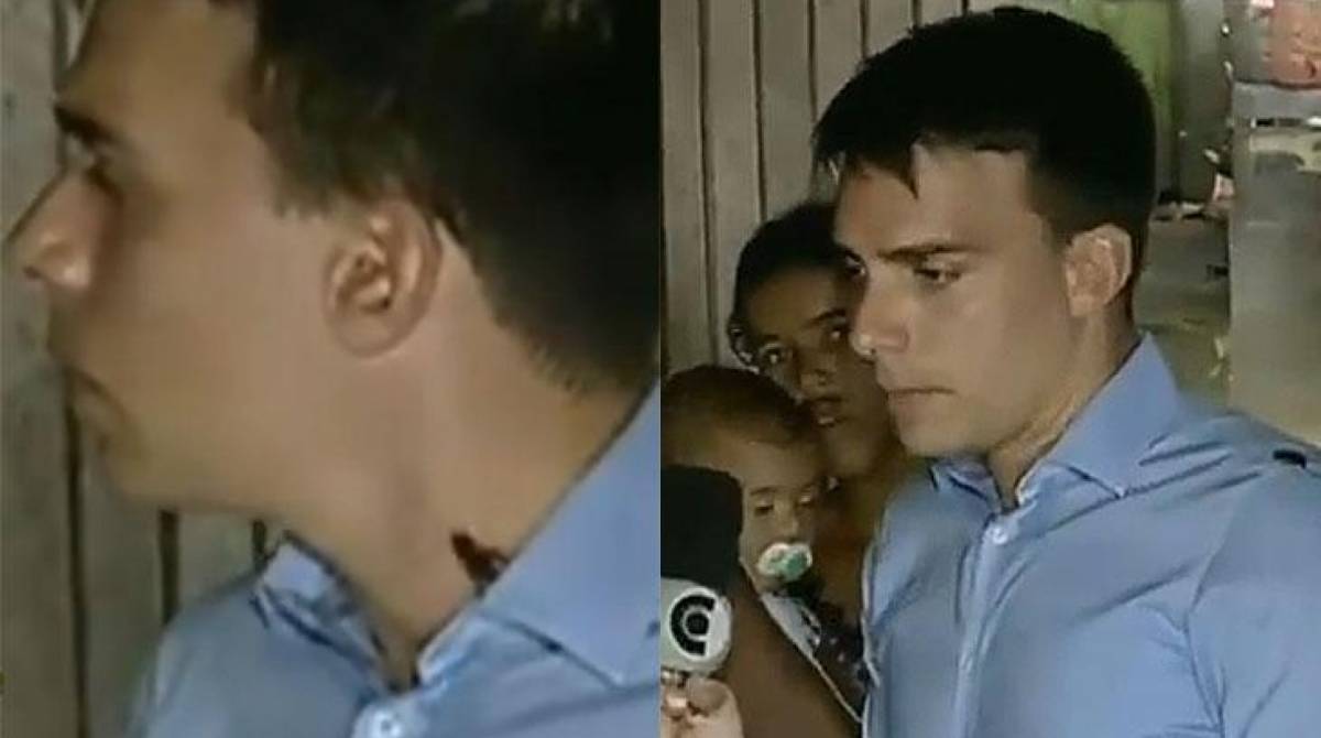 Barata sobe no pescoço de repórter durante entrevista ao vivo no 'Balanço Geral PE' - Reprodução Internet