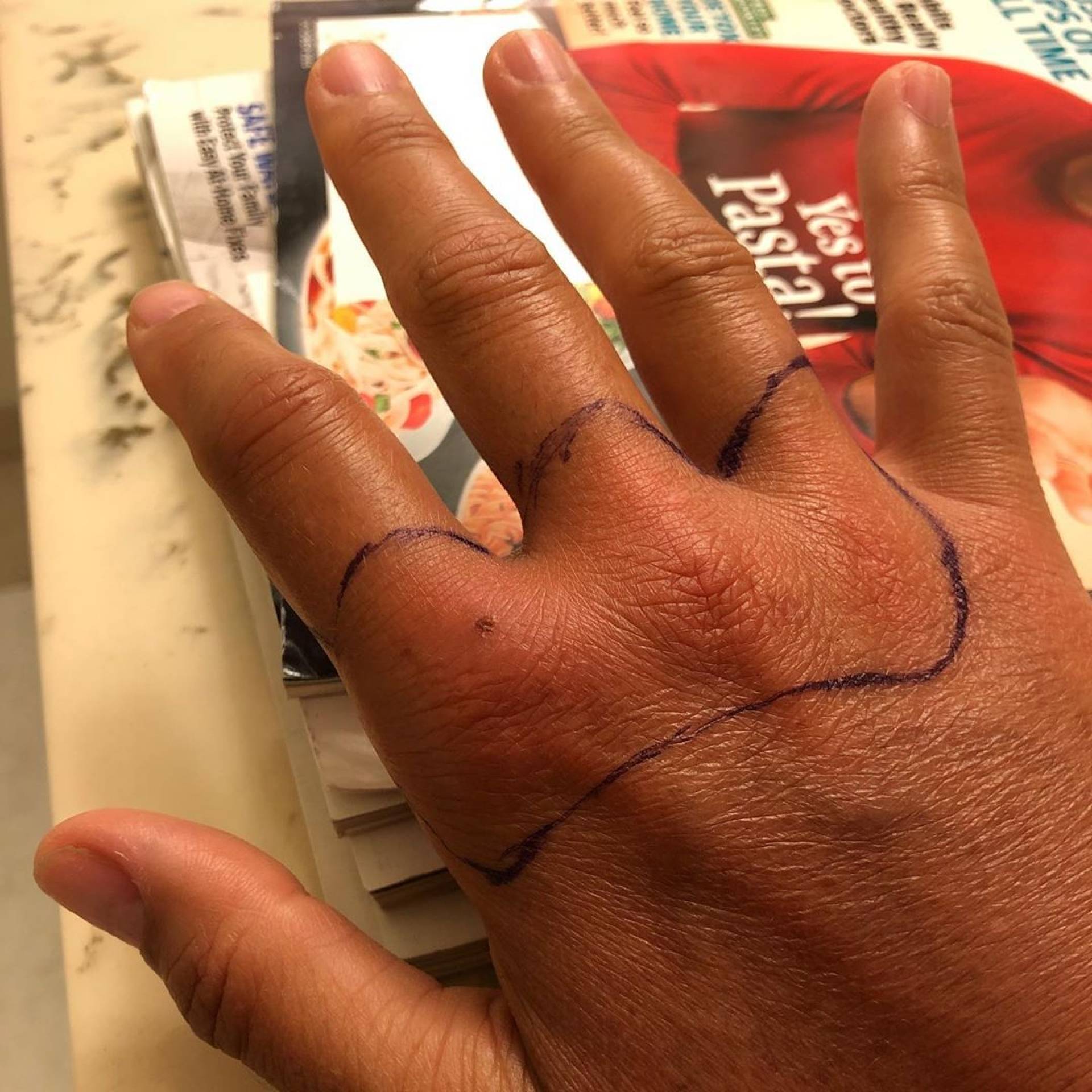 Daniela Escobar quase perde a mão após ser mordida por gato de estimação