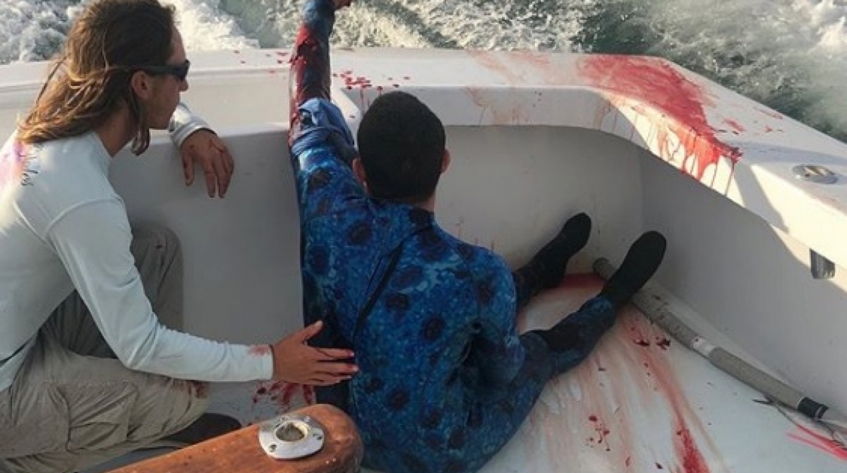 Mergulhador Ã© atacado por tubarÃ£o - Instagram