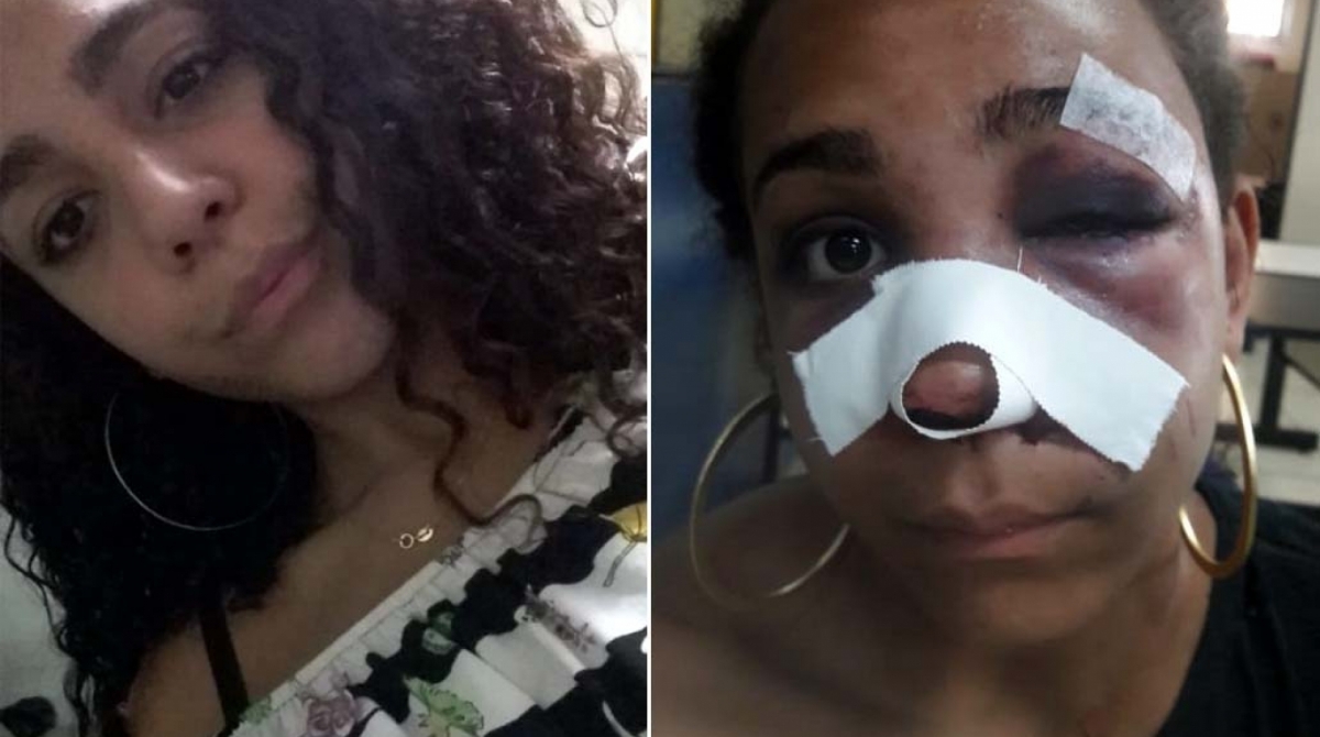 Marcela foi agredida na madrugada de s&aacute;bado - Arquivo Pessoal