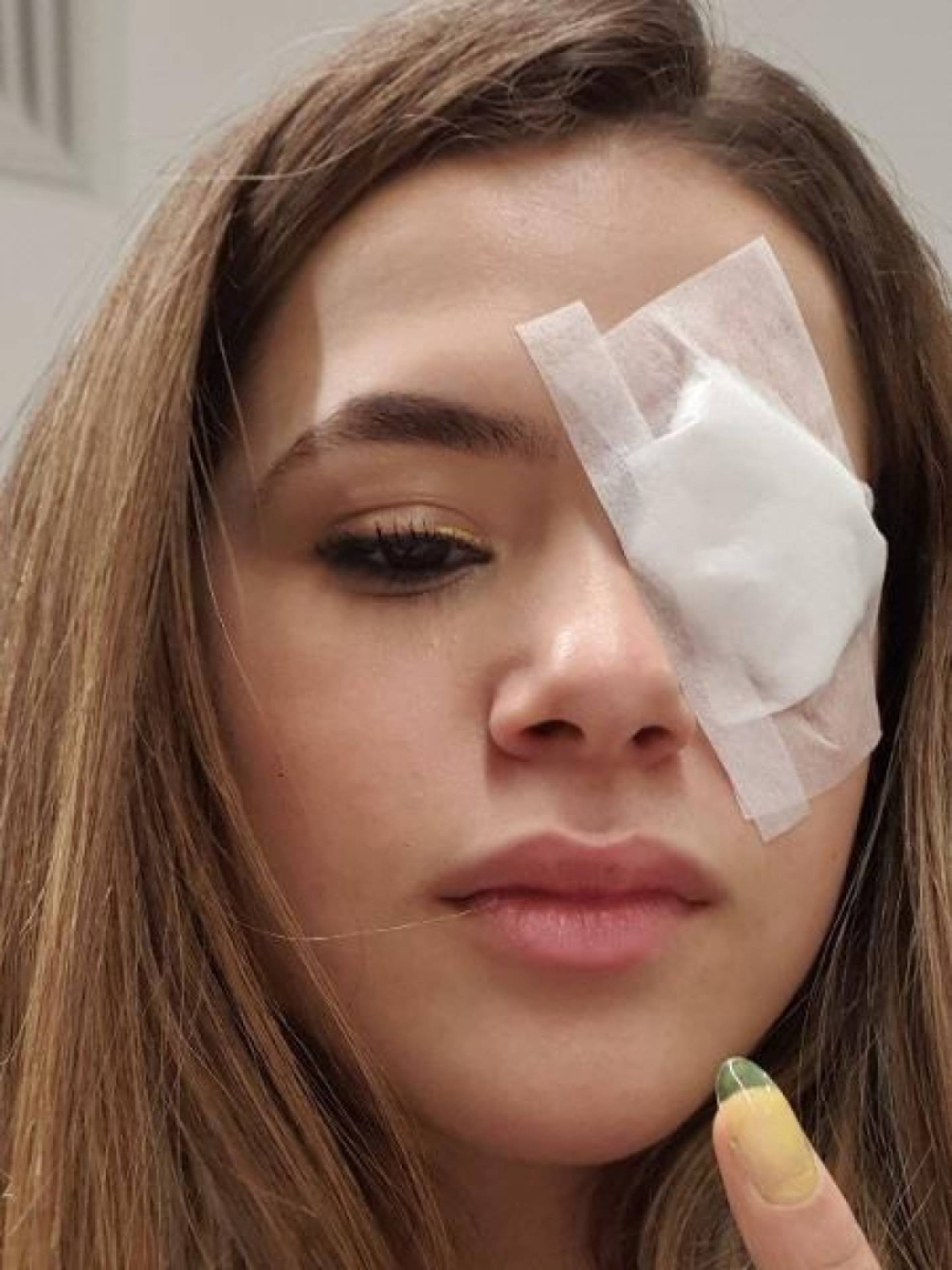 Maísa machuca o olho - Reprodução de internet