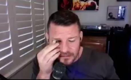 Ex-lutador do UFC mostra como retira e coloca olho de vidro; confira vídeo!