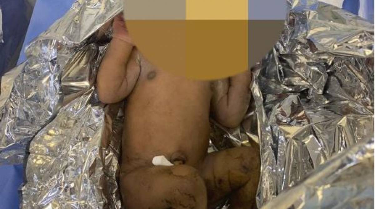 Bebê estava enrolada em plástico numa rua de Santa Cruz - Reprodução/WhatsApp O Dia