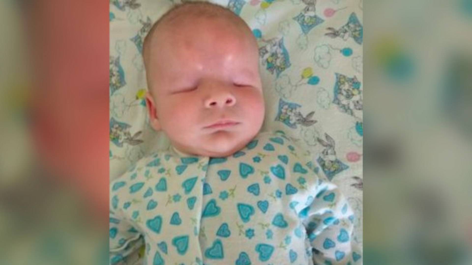 Drama! Com doença rara, bebê nasce sem olhos e busca um lar para viver