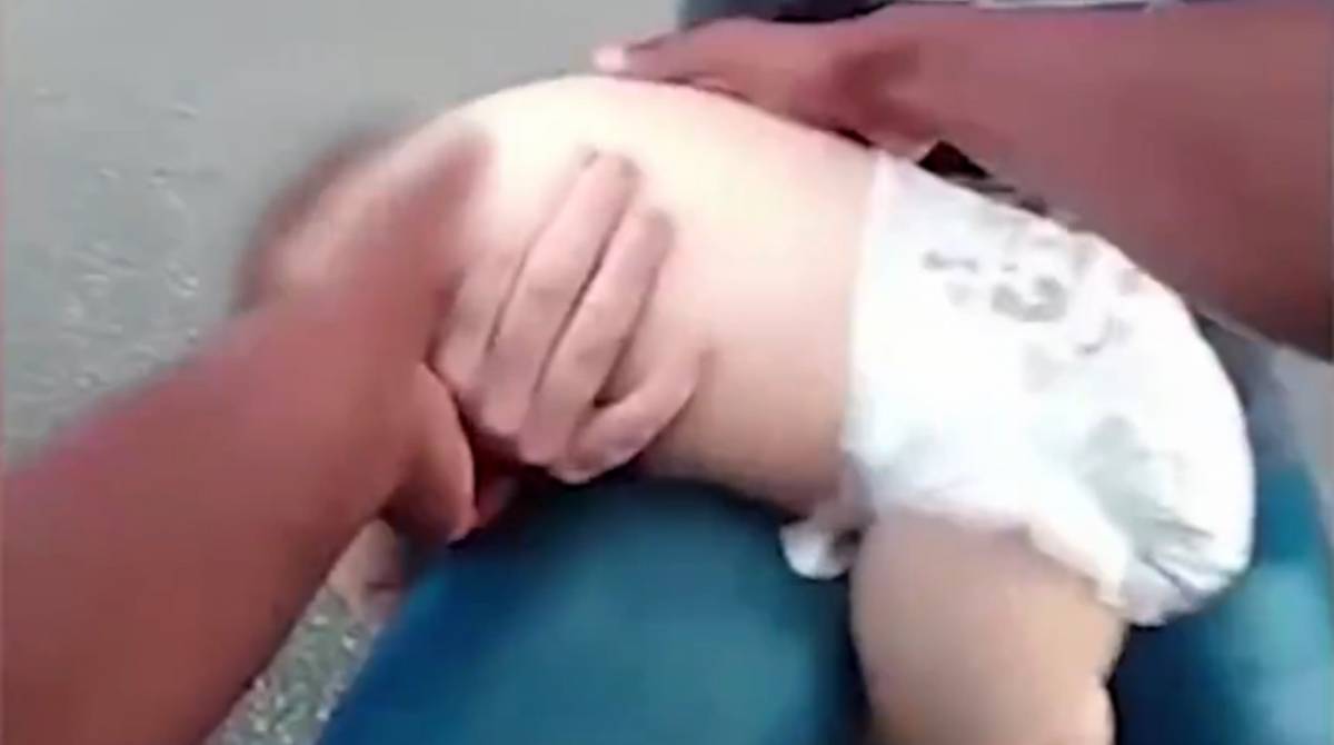 Criança ficou desacordada por minutos
 - Divulgação