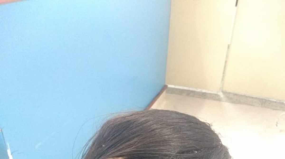 Mulher ficou com objeto cravado no crânio