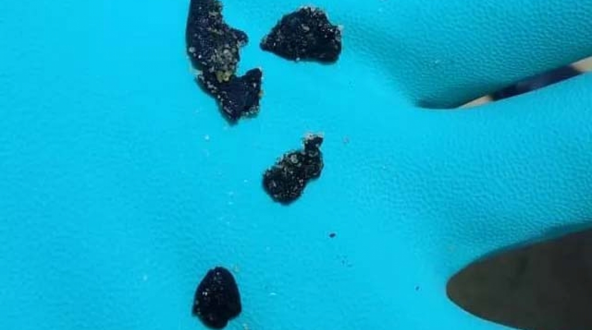 Fragmentos do &oacute;leo, cerca de 300 gramas, foram removidos
 - Divulga&ccedil;&atilde;o / Marinha